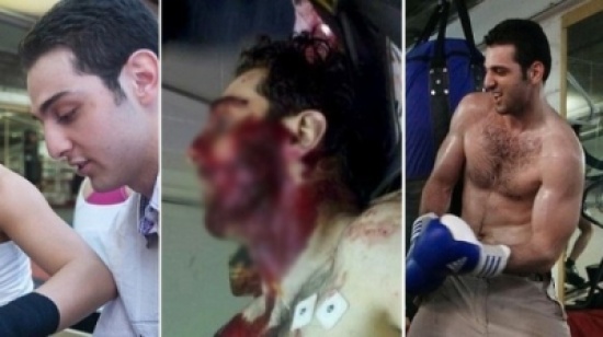صورة وحيدة دموية لمنفذ تفجير بوسطن وهو قتيل صورة وحيدة دموية لمنفذ تفجير بوسطن وهو قتيل
