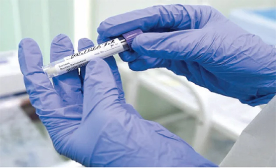 موجة ثالثة من الوباء قادمة للعالم وإلا..هذه الاستثناءات