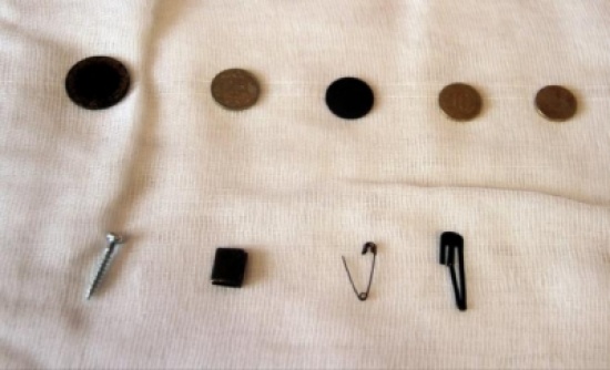 مستشفى تركي يعرض ما ابتلعه مرضاه