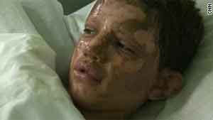 التوتر يستمر في ليبيا.. والأطفال بمقدمة الضحايا