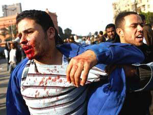 عشرات الجرحى في اشتباكات بين مؤيدين لمبارك ومعارضيه