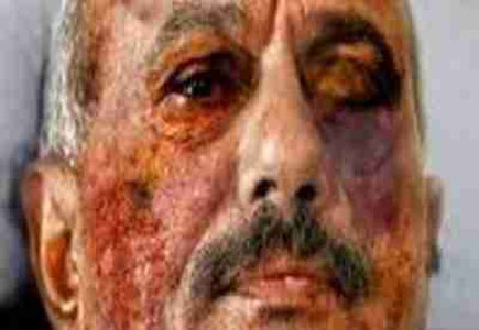صورة مزعومة غير مؤكدة للرئيس اليمنى 