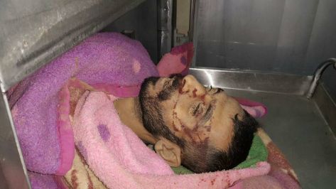 شهيدان وجرحى بقصف نفق بين مصر وغزة