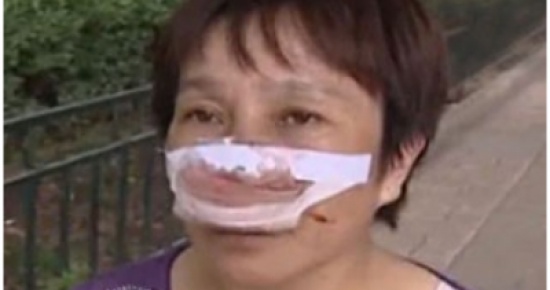 رجل صيني يعض أنف زوجته ويبتلعه رجل صيني يعض أنف زوجته ويبتلعه