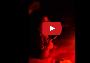 احتراق شعر طفلة بشمعة عيد ميلادها!