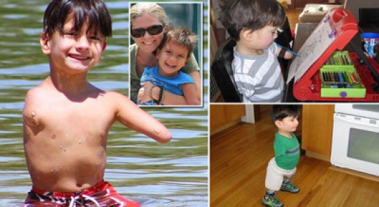 قصة حياة "طويلة" لطفل بعمر 5 سنوات