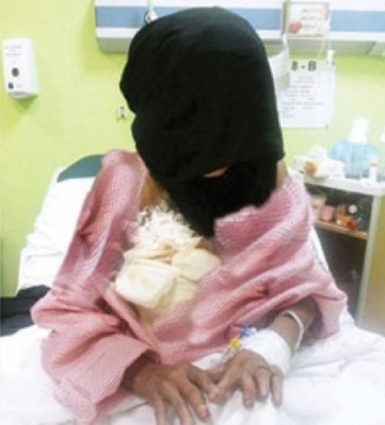 مدمن يحرق جسد زوجته بماء مغلي