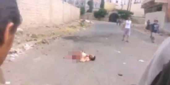 شاهد: انتحاري "تحرك وتكلم" بعد تفجير نفسه