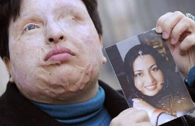 الحكم على إيراني باقتلاع عينيه وقطع أذنه