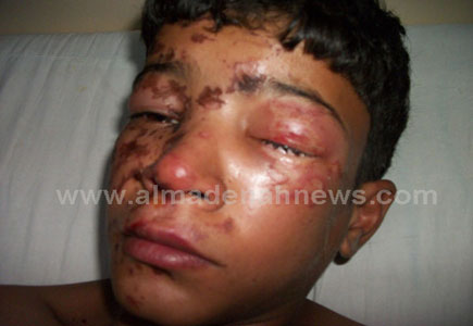 ماء نار على وجوه مواطنين في سوق خضار ( صور وفيديو ) 