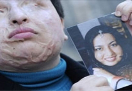 إيرانية تعفو عن شاب شوهها بالحامض وتترك عقابه لله