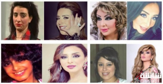 صور| نجمات انقلب جمالهن قبل وبعد التجميل!