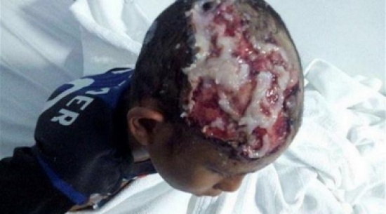 يسلخ رأس طفله ويضيف "الفلاش والكلوركس"