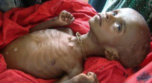 ناشطون أردنيون يطلقون حملة لإغاثة الشعب الصومالي 