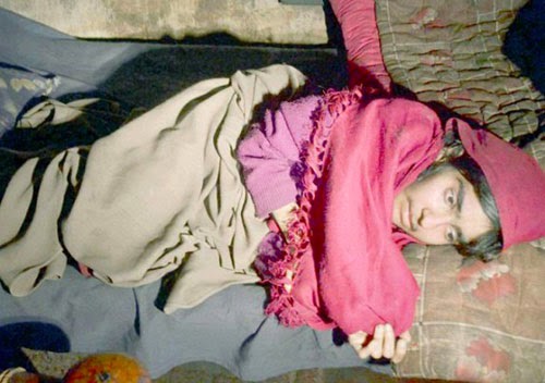 باكستاني يحبس ابنته 28 عاماً لأنها معاقة!!