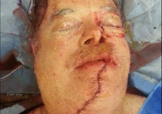 صور| حاول ربط وجهه ببعضه البعض محاولاً إنقاذ نفسه!