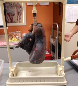 فيديو صادم للمدخنين سيغير حياتهم للأبد!