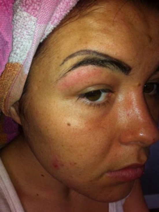 بالصور.. فتاة بأربعة حواجب بعد فشلها في وشم حاجبيها