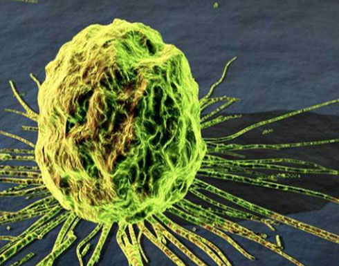 بولونيا تطور طريقة جديدة لعلاج السرطان