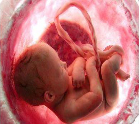 حامل ولَّدت نفسها فاختنق الطِّفل بالحبل السريّ!