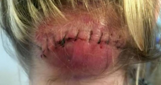 أكد لها أطباء أن حالتها لا تستدعي للقلق.. لكن الحقيقة كانت صادمة!