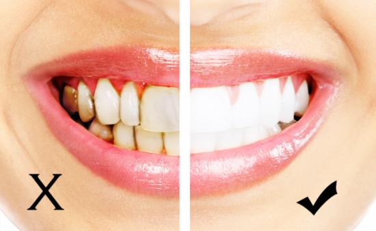 اطلاق حملة الوقاية من امراض الاسنان في اربد