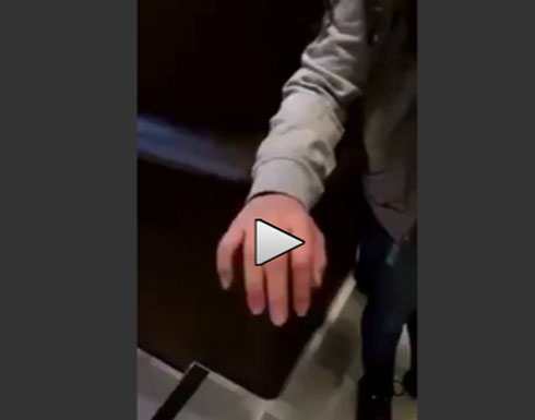 بالفيديو.. فتاة تثير الرعب بسبب يديها