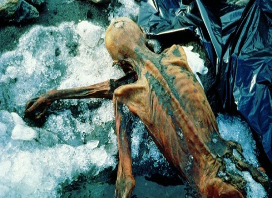 بالصور: العلماء يواصلون استنطاق مومياء رجل الجليد