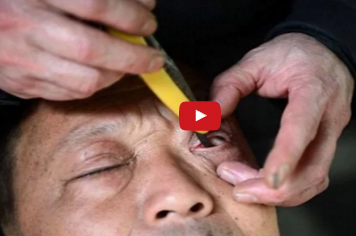 بالفيديو  : فن تنظيف العين بشفرة حادة في الصين !