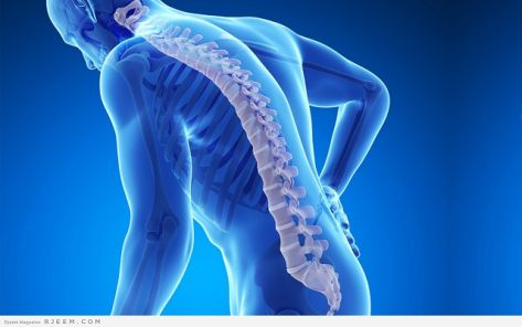 20 % من الأردنيين مصابون بترقق العظام