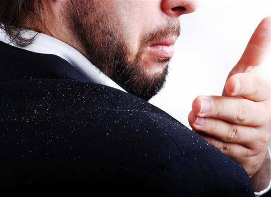 في هذه الحالة فقط تصبح الشامبوهات ضد القشرة غير مجدية! في هذه الحالة فقط تصبح الشامبوهات ضد القشرة غير مجدية!