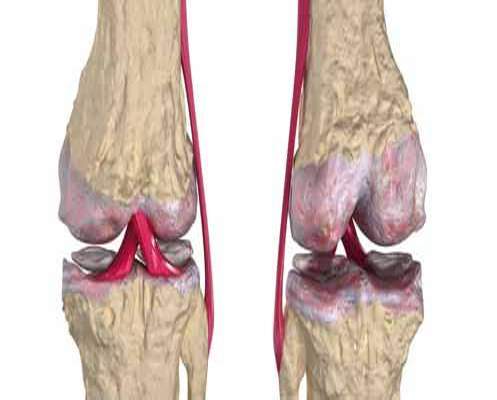الإعلان عن فعاليات مؤتمر الجمعية الأردنية لجراحي العظام