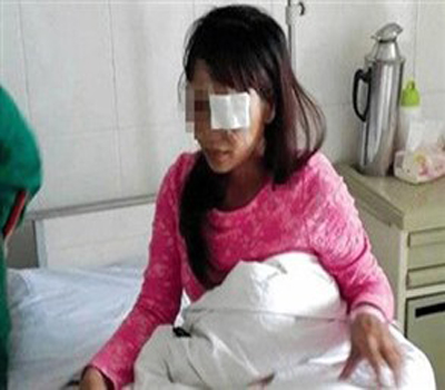 صيني ينتزع عين زوجته.. من الغيرة