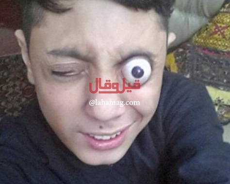 فيديو غريب - شاهدوا كيف يُخرج هذا الطفل مقلتيّ عينيه من مكانهما... لا يُصدّق! فيديو غريب - شاهدوا كيف يُخرج هذا الطفل مقلتيّ عينيه من مكانهما... لا يُصدّق!