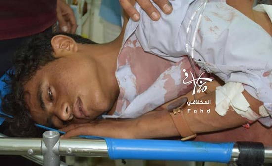 صور مرعبة.. أطفال ضحايا قصف حوثي لحي سكني بتعز صور مرعبة.. أطفال ضحايا قصف حوثي لحي سكني بتعز