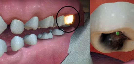 فيديو| أحس بألم بأسنانه بعد أن أكل حبة جوافة!!