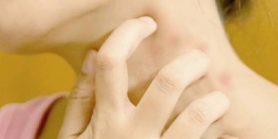 إذا احمرّ جلدك وتقشر.. إحذر إذا احمرّ جلدك وتقشر.. إحذر