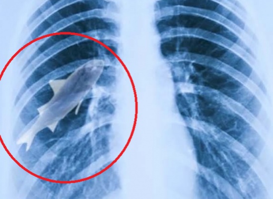 بالصور.. 8 كائنات غريبة وجدت "على قيد الحياة" في جسم الانسان!