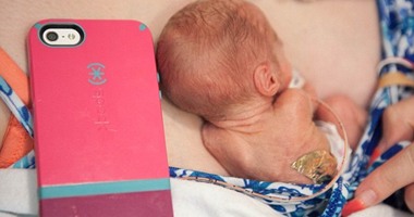بالفيديو.. ولادة طفلة أمريكية بحجم الـ"آي فون" بالفيديو.. ولادة طفلة أمريكية بحجم الـ"آي فون"