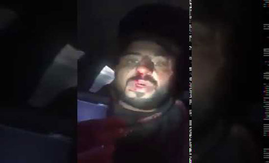 بالفيديو - متظاهر عراقي: "شوفوا القبعات الزرق كسروا أنفي وطعنوني"