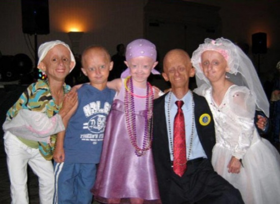 بالصور :  أندر 10 أمراض في العالم