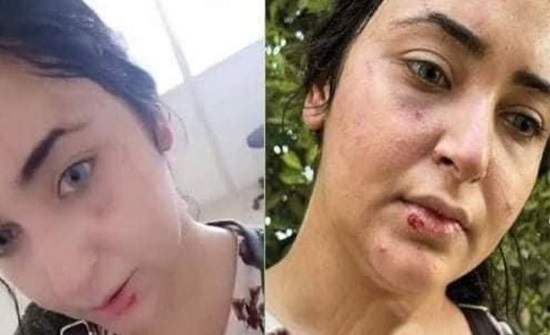 بعد أن زعمت تعرضها للضرب.. إخلاء سبيل صيدلانية مصرية بعد أن زعمت تعرضها للضرب.. إخلاء سبيل صيدلانية مصرية