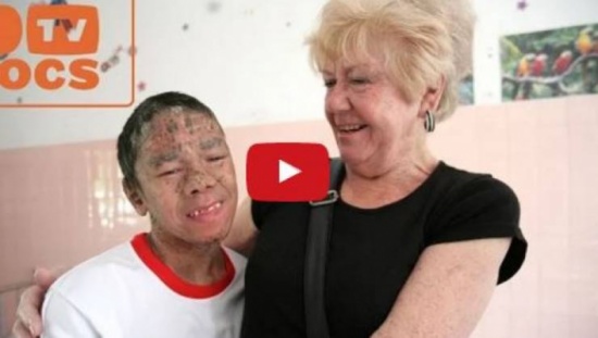 فيديو| سخروا منه ولقبوه بالسمكة.. لكن ما تفعله هذه السيدة له مؤثر جداً؟