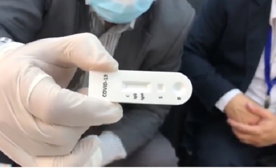 الصحة: شرائح مستوردة حديثا تختصر مدة الفحص وتعطي نتائج دقيقة