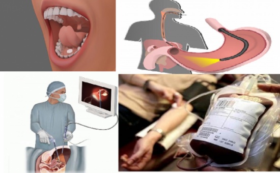 تجنباً لإفساد صيامك.. ماذا تعرف عن المفطرات المعاصرة؟ تجنباً لإفساد صيامك.. ماذا تعرف عن المفطرات المعاصرة؟