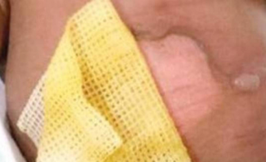 حدث في بلد عربي ممرضة تحرق رضيعاً.. وهذه مصيرها! حدث في بلد عربي ممرضة تحرق رضيعاً.. وهذه مصيرها!