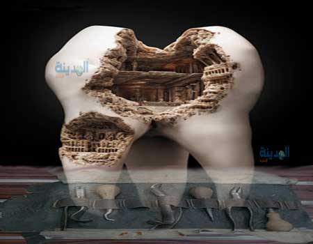 عملية جراحية فى الفك والاسنان قبل التاريخ ( صور )