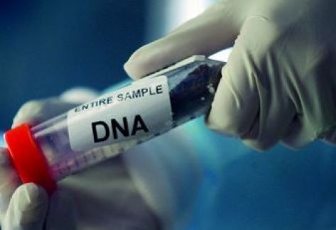 فحص ''DNA'' لعائلات مشتبه بأن أبناءها قُتلوا بعملية إربد فحص ''DNA'' لعائلات مشتبه بأن أبناءها قُتلوا بعملية إربد