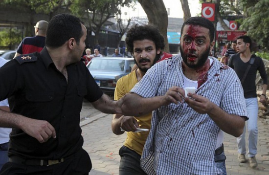 وزارة الصحة المصرية: 34 مصاباً باشتباكات الجمعة وزارة الصحة المصرية: 34 مصاباً باشتباكات الجمعة