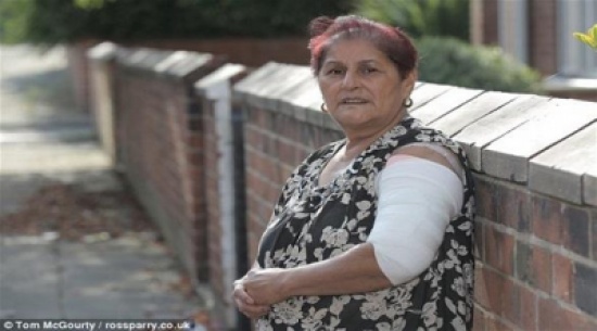 أنظر ماذا فعل كلب لذراع هذه المرأة